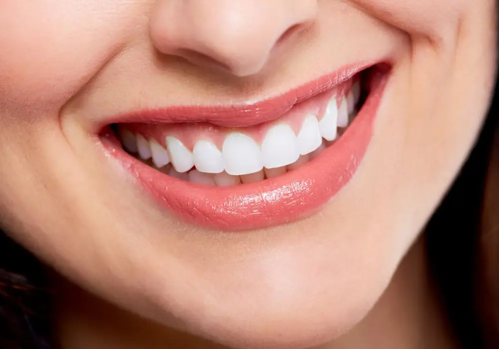 Smile Makeovers at Subash Dental Care Chennai